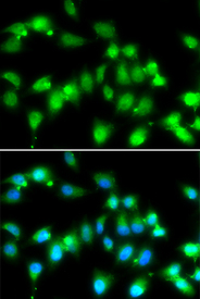 Immunofluorescence blot of HeLa cell using AKAP5 antibody. Blue: DAPI for nuclear staining.