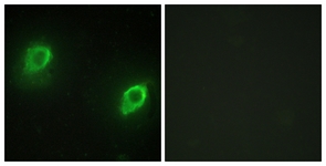 Immunofluorescence of HeLa cells, using AKAP5 Antibody. The picture on the right is treated with the synthesized peptide.