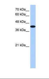 HepG2 cell lysate. Antibody concentration: 1.25 ug/ml. Gel concentration: 12%.