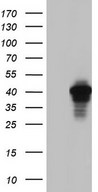 HEK293T cells were transfected with the pCMV6-ENTRY control (Left lane) or pCMV6-ENTRY AKAP7 (Right lane) cDNA for 48 hrs and lysed. Equivalent amounts of cell lysates (5 ug per lane) were separated by SDS-PAGE and immunoblotted with anti-AKAP7.