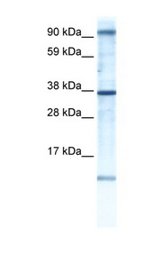 AKAP7 antibody LS-B1509 Western blot of Fetal brain lysate.