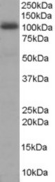 Antibody staining (1 ug/ml) of Human Liver lysate (RIPA buffer, 35 ug total protein per lane). Primary incubated for 1 hour. Detected by Western blot of chemiluminescence.