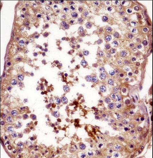 AKAP4 Antibody immunohistochemistry of formalin-fixed and paraffin-embedded human testis tissue followed by peroxidase-conjugated secondary antibody and DAB staining.