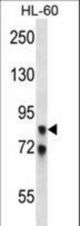 AKAP4 Antibody western blot of HL-60 cell line lysates (35 ug/lane). The AKAP4 antibody detected the AKAP4 protein (arrow).
