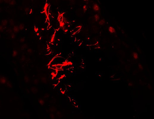 Immunofluorescence of AKAP4 in human testis tissue with AKAP4 antibody at 20 ug/ml.