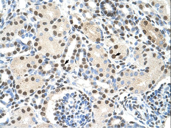 AKAP8L antibody LS-C31359 was used in IHC to stain formalin-fixed, paraffin-embedded human kidney.
