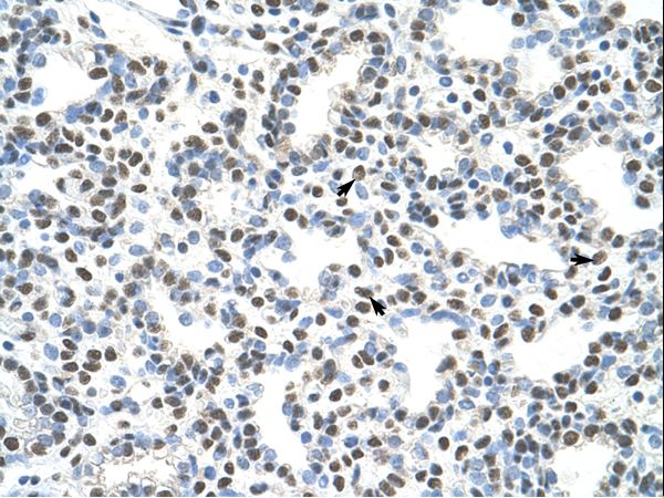 AKAP8L antibody LS-C31359 was used in IHC to stain formalin-fixed, paraffin-embedded human lung.