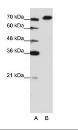 A: Marker, B: Jurkat Cell Lysate