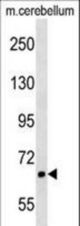 AKAP8L Antibody western blot of mouse cerebellum tissue lysates (35 ug/lane). The AKAP8L antibody detected the AKAP8L protein (arrow).