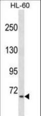AKAP8L Antibody western blot of HL-60 cell line lysates (35 ug/lane). The AKAP8L antibody detected the AKAP8L protein (arrow).