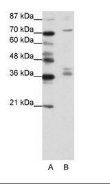 A: Marker, B: Jurkat Cell Lysate