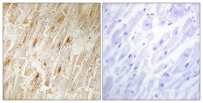 IHC of paraffin-embedded human heart tissue, using BCA3 Antibody. The picture on the right is treated with the synthesized peptide.