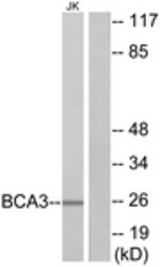 Western blot of extracts from Jurkat cells, using BCA3 Antibody. The lane on the right is treated with the synthesized peptide.