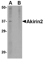 Western blot of Akirin2 in mouse brain tissue lysate with Akirin2 antibody at 1 ug/ml in (A) the absence and (B) the presence of blocking peptide.