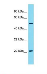 Western blot of Mouse Spleen. Akirin2 antibody dilution 1.0 ug/ml.