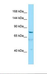 Western blot of Human HepG2. AKNA antibody dilution 1.0 ug/ml.