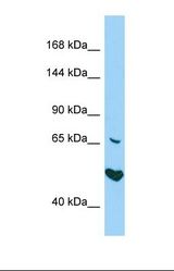 Western blot of Human HepG2. AKNA antibody dilution 1.0 ug/ml.
