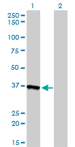 Western blot of AKR1A1 expression in transfected 293T cell line by AKR1A1 monoclonal antibody (M01), clone 1A11-2A4.