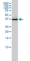 AKR1A1 monoclonal antibody (M01), clone 1A11-2A4 Western blot of AKR1A1 expression in HL-60.