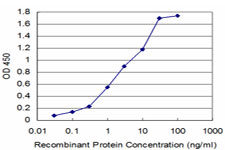 Detection limit for recombinant GST tagged AKR1A1 is approximately 0.1 ng/ml as a capture antibody.