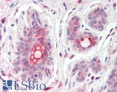 Anti-ABCC11 / MRP8 antibody IHC staining of human breast. Immunohistochemistry of formalin-fixed, paraffin-embedded tissue after heat-induced antigen retrieval.