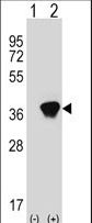 Western blot of AKR1A1 (arrow) using rabbit polyclonal AKR1A1 Antibody. 293 cell lysates (2 ug/lane) either nontransfected (Lane 1) or transiently transfected (Lane 2) with the AKR1A1 gene.