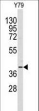 Western blot of anti-AKR1A1 Antibody in Y79 cell line lysates (35 ug/lane). AKR1A1(arrow) was detected using the purified antibody.