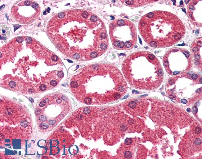 Anti-AKR1A1 antibody IHC of human kidney. Immunohistochemistry of formalin-fixed, paraffin-embedded tissue after heat-induced antigen retrieval. Antibody LS-B2745 concentration 5 ug/ml.