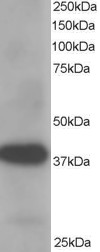 Antibody staining (1 ug/ml) of Human Placenta lysate (RIPA buffer, 35 ug total protein per lane). Primary incubated for 1 hour. Detected by Western blot of chemiluminescence.