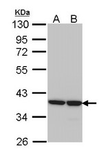 Sample (30 ug of whole cell lysate). A: 293T. B: A431. 10% SDS PAGE. AKR1B1 antibody diluted at 1:1000.