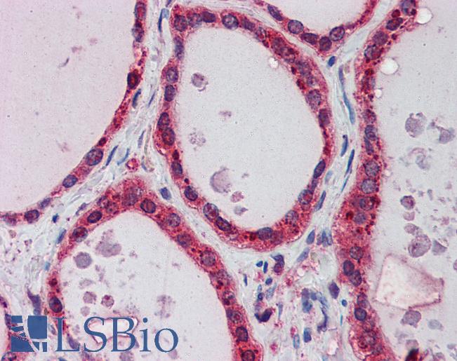 Anti-AKR1B1 antibody IHC of human thyroid. Immunohistochemistry of formalin-fixed, paraffin-embedded tissue after heat-induced antigen retrieval. Antibody LS-B5811 concentration 5 ug/ml.