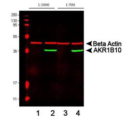 AKR1B10 Antibody - WB analysis of AKR1B10 expression in RKO cell lysate (Lanes 1 & 3) and HCT-8 cell lysate (Lanes 2 & 4).
