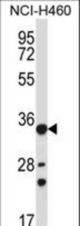 AKR1B10 Antibody western blot of NCI-H460 cell line lysates (35 ug/lane). The AKR1B10 antibody detected the AKR1B10 protein (arrow).