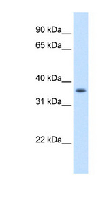AKR1B10 antibody LS-C40392 Western blot of A549 cell lysate.