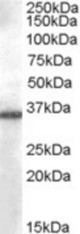 Antibody (0.03 ug/ml) staining of A549 cell lysate (35 ug protein in RIPA buffer). Primary incubation was 1 hour. Detected by chemiluminescence.