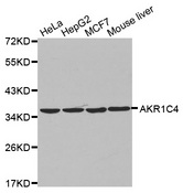 Western blot analysis of extracts of various cell lines, using AKR1C4 antibody.