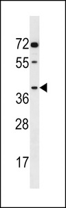 AKR1E2 Antibody western blot of A549 cell line lysates (35 ug/lane). The AKR1E2 antibody detected the AKR1E2 protein (arrow).