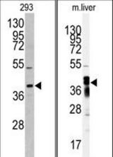 Western blot of anti-AKR7A2 antibody in 293 cell line lysates (35 ug/lane). AKR7A2 (arrow) was detected using the purified antibody. Western blot of anti-AKR7A2 Antibody in mouse liver tissue lysates (35 ug/lane). AKR7A2 (arrow) was detected using the purified antibody.