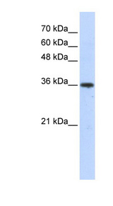 AKR7A3 antibody LS-C110890 Western blot of Transfected 293T cell lysate.