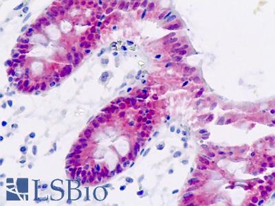 Human, Colon: Formalin-Fixed Paraffin-Embedded (FFPE)
