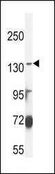 ABCC3 Antibody western blot of MDA-MB435 cell line lysates (35 ug/lane). The ABCC3 antibody detected the ABCC3 protein (arrow).