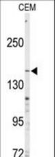 Western blot of anti-ABCC4 Antibody in CEM cell line lysates (35 ug/lane). ABCC4 (arrow) was detected using the purified antibody.