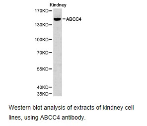 Western blot.