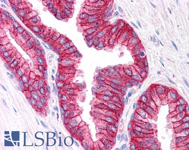 Anti-ABCC4 / MRP4 antibody IHC of human prostate. Immunohistochemistry of formalin-fixed, paraffin-embedded tissue after heat-induced antigen retrieval. Antibody LS-B4 concentration 5 ug/ml.