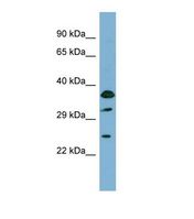 Western blot of Human COLO205. ABCC5 antibody dilution 1.0 ug/ml.