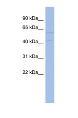 AKT2 antibody LS-C112288 Western blot of 3 Cell lysate. Antibody concentration 1 ug/ml.