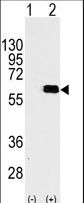 Western blot of AKT2 (arrow) using rabbit polyclonal AKT2 Antibody (S474) (RB11384). 293 cell lysates (2 ug/lane) either nontransfected (Lane 1) or transiently transfected with the AKT2 gene (Lane 2) (Origene Technologies).