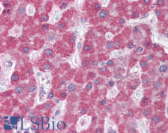 Anti-ABCC5 / MRP5 antibody IHC of human liver. Immunohistochemistry of formalin-fixed, paraffin-embedded tissue after heat-induced antigen retrieval. Antibody LS-B2334 concentration 5 ug/ml.