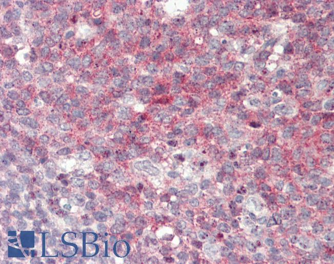 Human Tonsil: Formalin-Fixed, Paraffin-Embedded (FFPE)