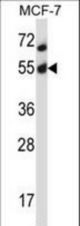 Mouse Akt2 Antibody western blot of MCF-7 cell line lysates (35 ug/lane). The Akt2 antibody detected the Akt2 protein (arrow).